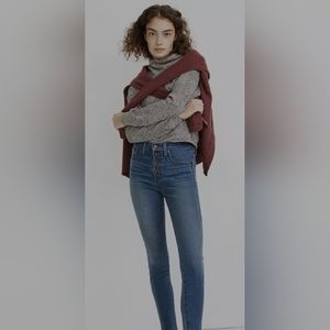 Madewell 10" High Rise Vintage Button Fly Skinny Jeans